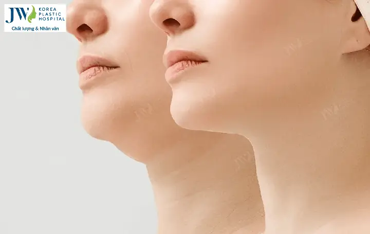 Cằm Tướng Số