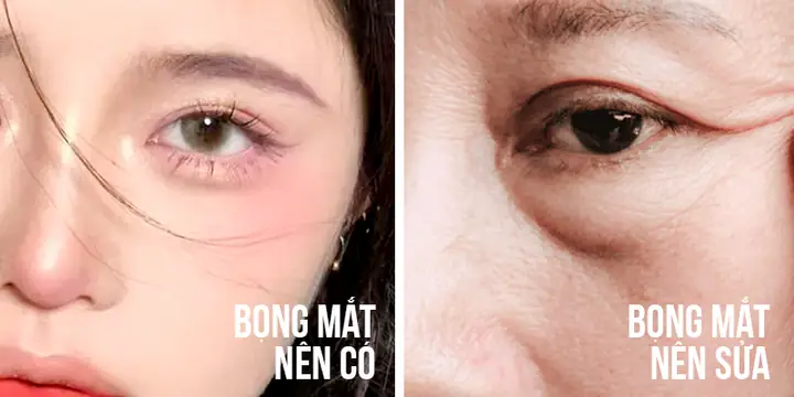 Bọng Mắt Tướng Số