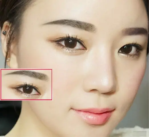 Các Loại Tướng Mắt