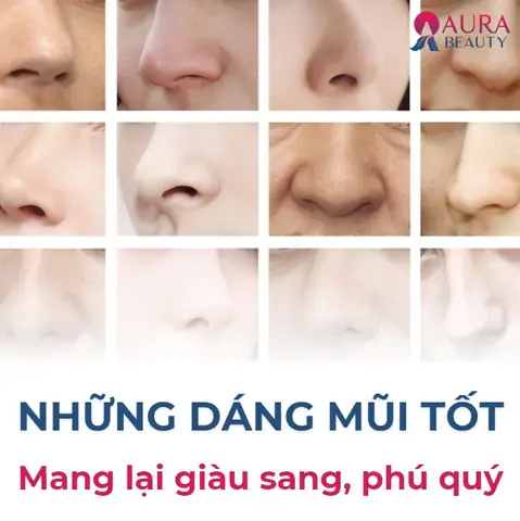 Các Loại Tướng Mũi Các Loại Tướng Mũi