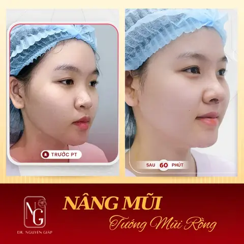 Các Tướng Mũi Rồng Các Tướng Mũi Rồng