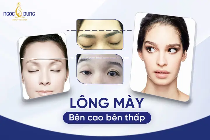 Cách Sửa Tướng Lông Mày