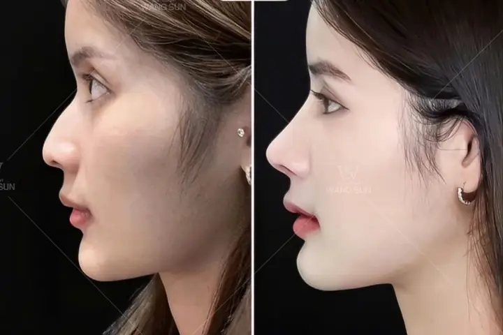 Cải Thiện Tướng Số