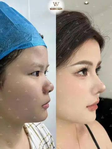 Cải Thiện Tướng Số Cải Thiện Tướng Số