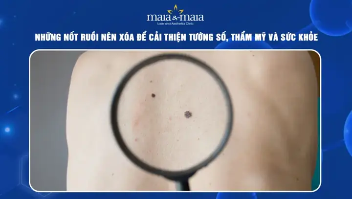 Cải Thiện Tướng Số Cải Thiện Tướng Số