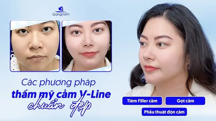 Cằm Nhọn Tướng Số