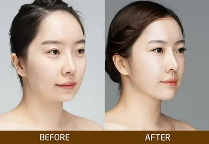 Cằm V Line Tướng Số