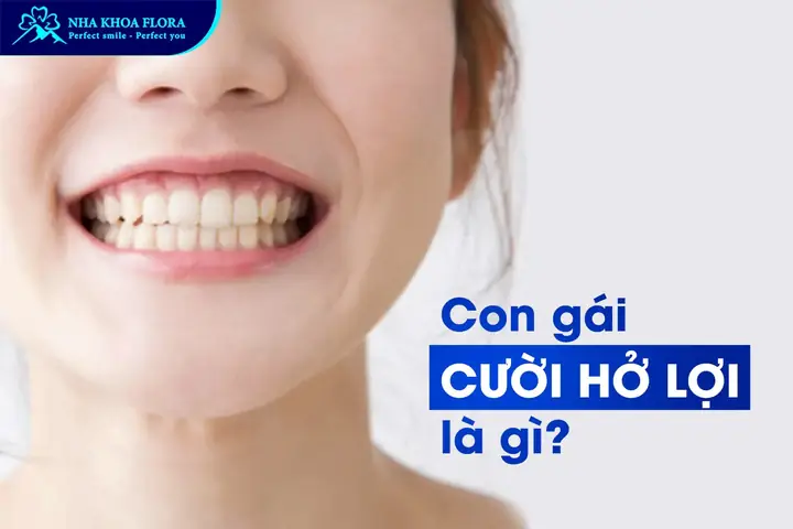 Con Gái Cười Hở Lợi Tướng Số