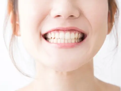 Con Gái Cười Hở Lợi Tướng Số