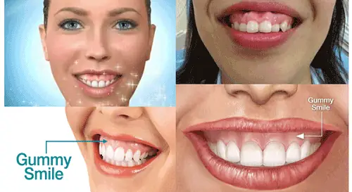 Cười Hở Lợi Tướng Số Đàn Bà Cười Hở Lợi Tướng Số Đàn Bà