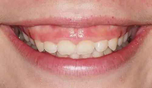Cười Hở Lợi Tướng Số Đàn Bà