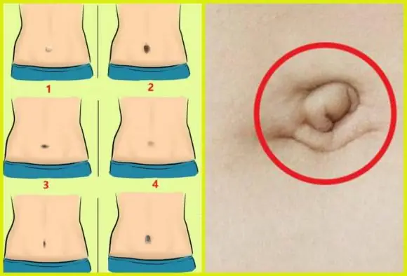 Đoán Biết Tương Lai Sướng Khổ Qua Tướng Rốn