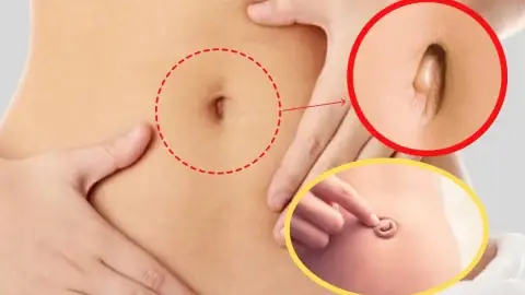 Đoán Biết Tương Lai Sướng Khổ Qua Tướng Rốn