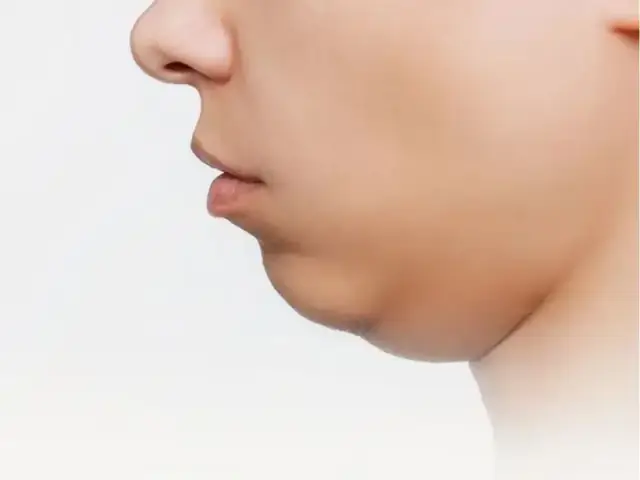 Hai Cằm Trong Tướng Số