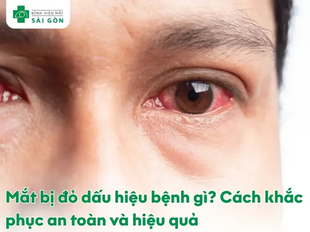 Hay Bị Bệnh Về Mắt Và Tướng Số