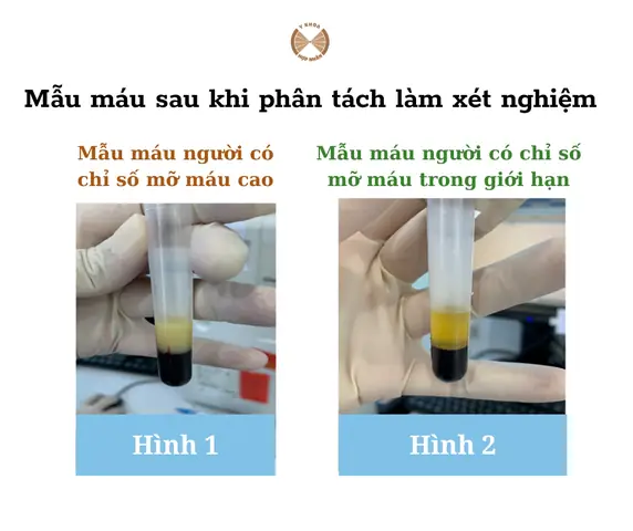 Hình Mẫu Mặt Trong Tướng Số
