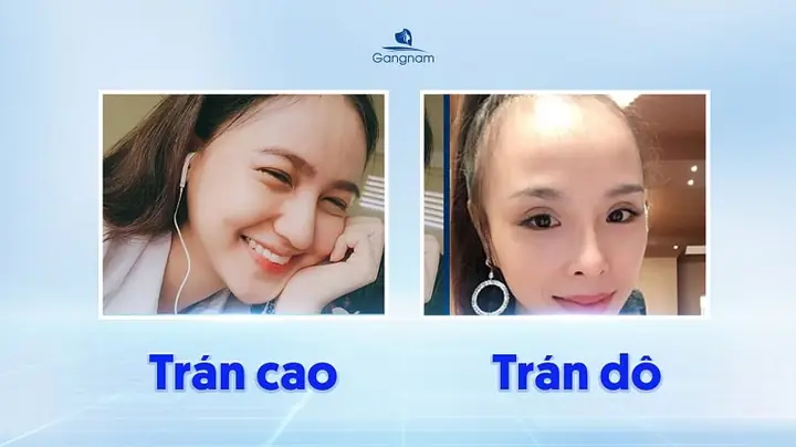 Hình Tướng Lông Mày Trổ Ngược