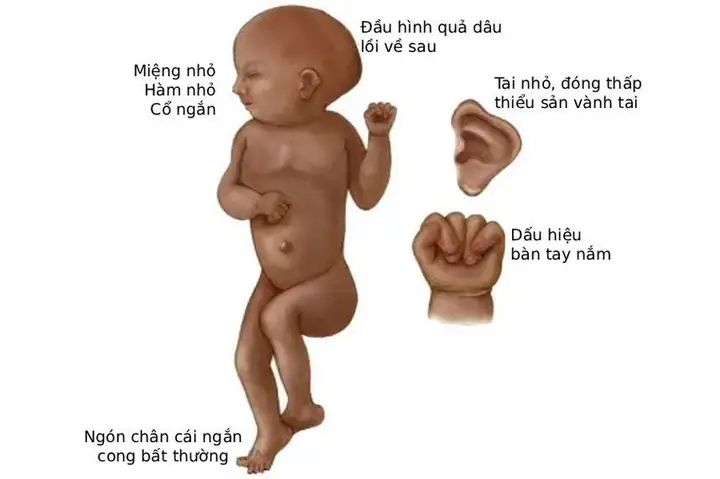 Hỏi Gì Khi Xem Tướng Số