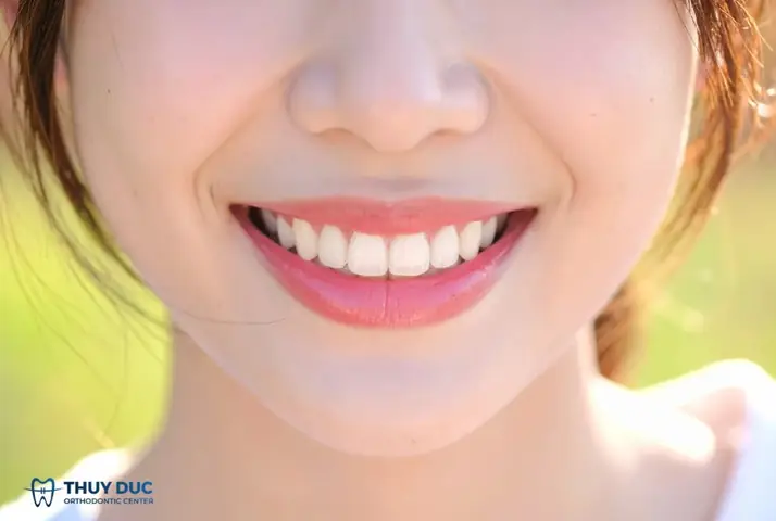 Làm Răng Có Thay Đổi Tướng Số