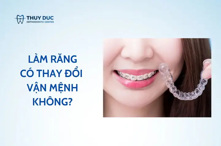 Làm Răng Có Thay Đổi Tướng Số