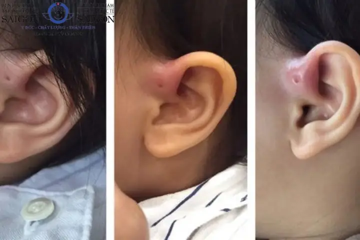 Lỗ Rò Luân Nhĩ Tướng Số Lỗ Rò Luân Nhĩ Tướng Số