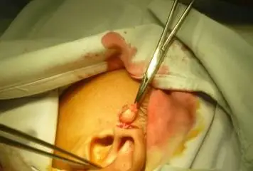 Lỗ Rò Luân Nhĩ Tướng Số Lỗ Rò Luân Nhĩ Tướng Số