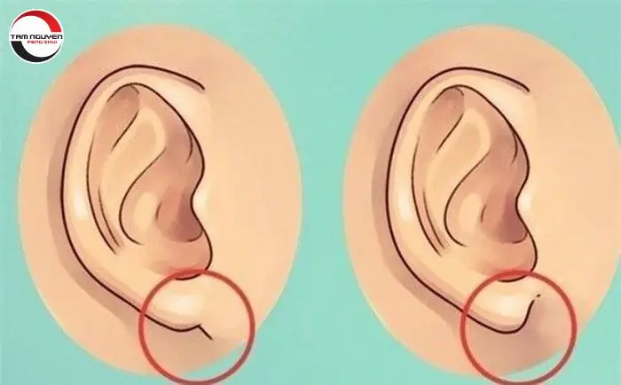 Lỗ Tai Nhỏ Tướng Số Lỗ Tai Nhỏ Tướng Số