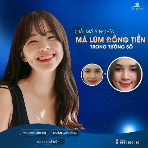 Lúm Đồng Tiền Theo Tướng Số