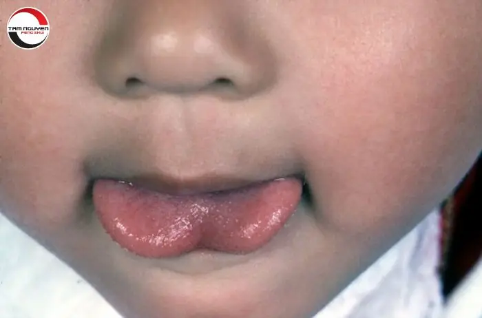 Lưỡi Chẻ Tướng Số