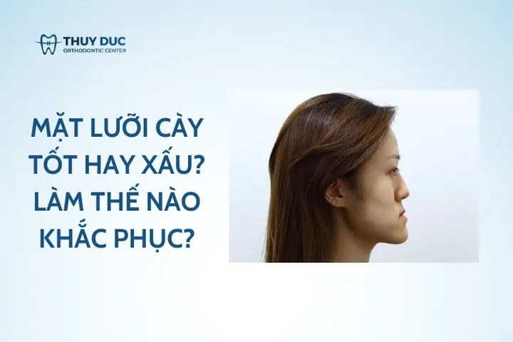 Mặt Bị Gãy Tướng Số Ra Sao