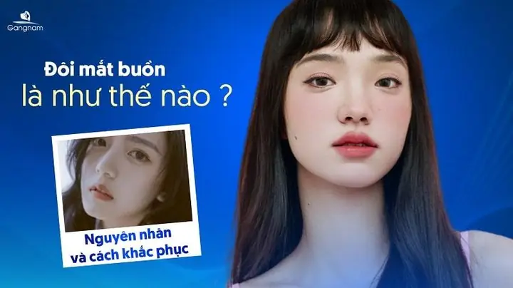 Mắt Buồn Tướng Số