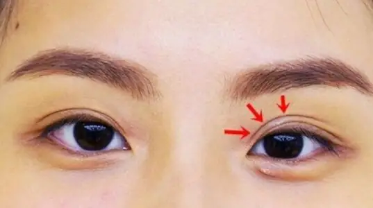 Mắt Hai Mí Sụp Tướng Số Mắt Hai Mí Sụp Tướng Số