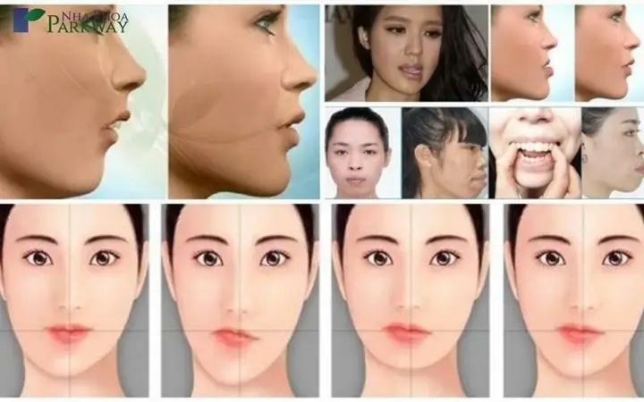 Mặt Lệch Tướng Số Mặt Lệch Tướng Số