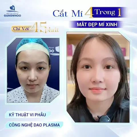 Mắt Phượng Trong Tướng Số
