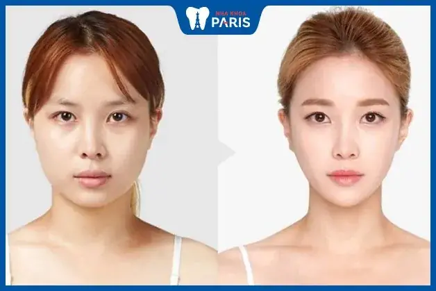 Mặt Tròn Tướng Số Mặt Tròn Tướng Số