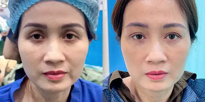 Mắt Trong Tướng Số
