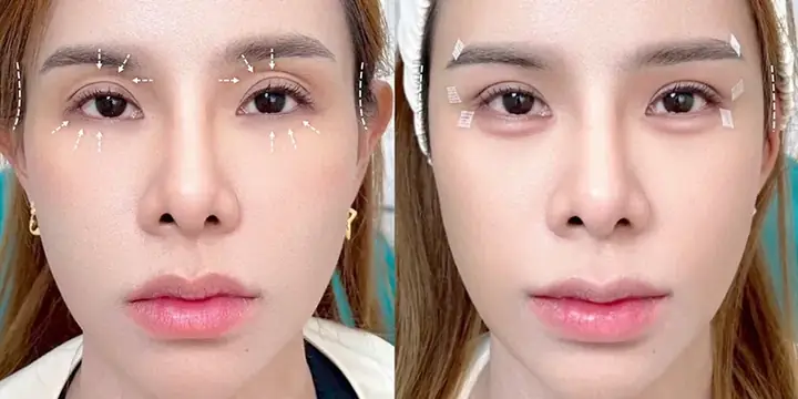 Mắt Trong Tướng Số Mắt Trong Tướng Số