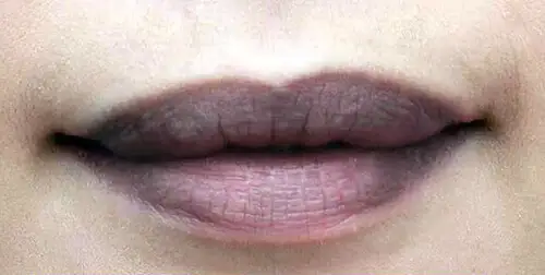 Môi Thâm Tướng Số Môi Thâm Tướng Số
