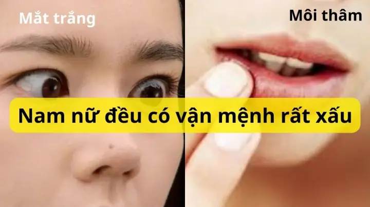Môi Thâm Tướng Số