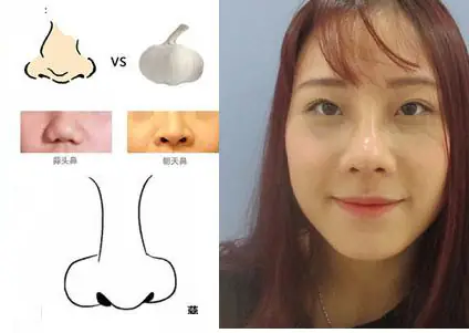 Mũi Củ Tỏi Tướng Số
