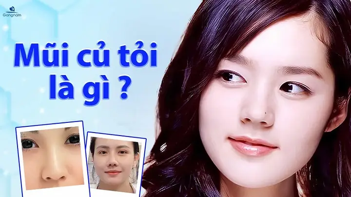 Mũi Củ Tỏi Tướng Số