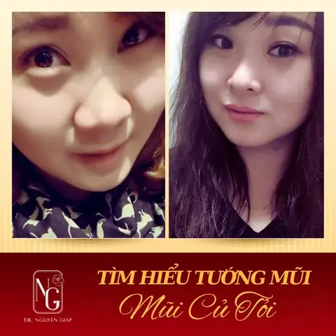 Mũi Củ Tỏi Tướng Số