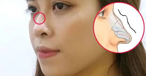 Mũi Gồ Tướng Số