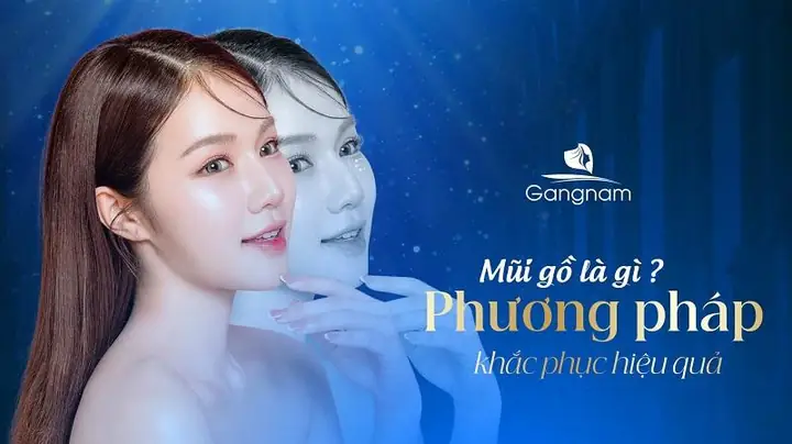 Mũi Gồ Tướng Số
