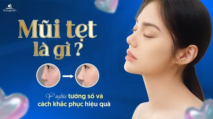 Mũi Tẹt Tướng Số