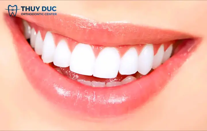Nam Giới Tướng Răng Nào Là Đẹp Nhất