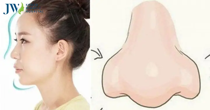 Nam Tướng Mũi Cà Chua Nam Tướng Mũi Cà Chua
