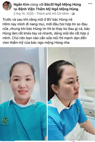 Nâng Mũi Thay Đổi Tướng Số