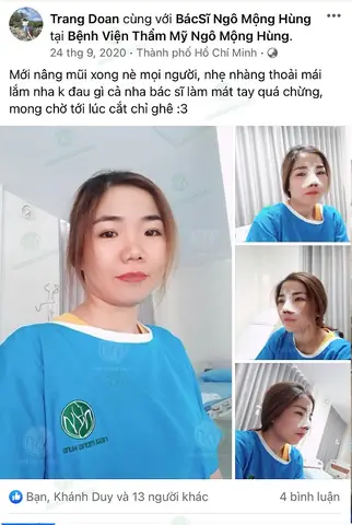Nâng Mũi Thay Đổi Tướng Số Webtretho Nâng Mũi Thay Đổi Tướng Số Webtretho