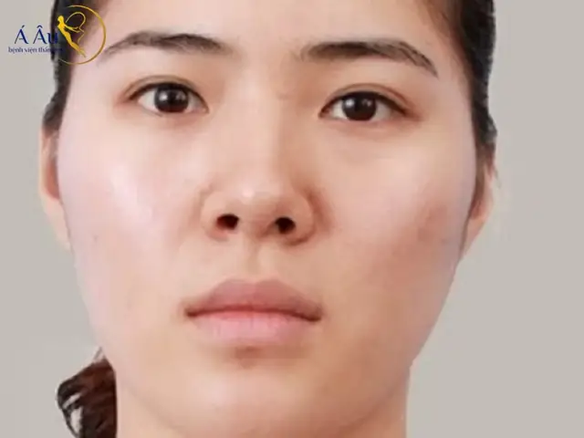 Người Có Tướng Mũi Hếch